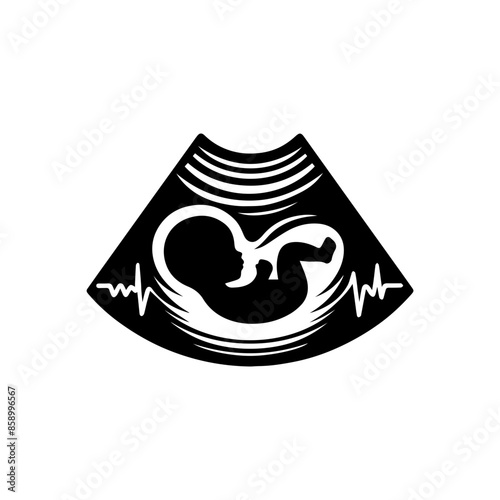 Baby Sonogram Diagram Clipart