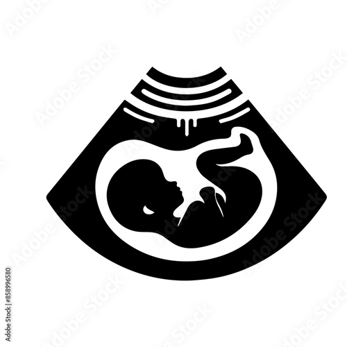 Baby Sonogram Diagram Clipart