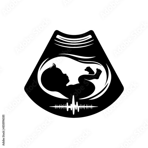 Baby Sonogram Diagram Clipart