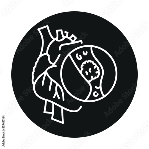 Thrombosis of the heart line black icon. Signs for web page