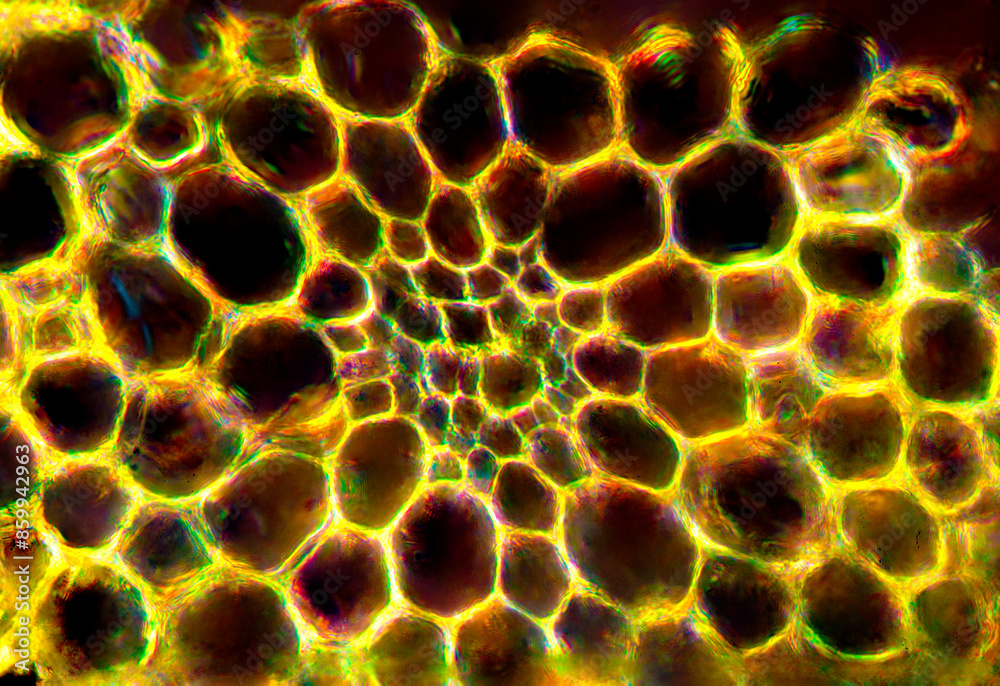 Bright yellow micrograph of a moss branch in transverse section. Bright yellow micrograph of a moss branch in transverse section.