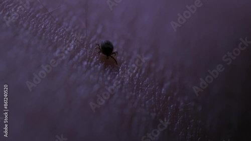 A tick on the skin that transmits dangerous diseases such as tick-borne encephalitis or Lyme disease.