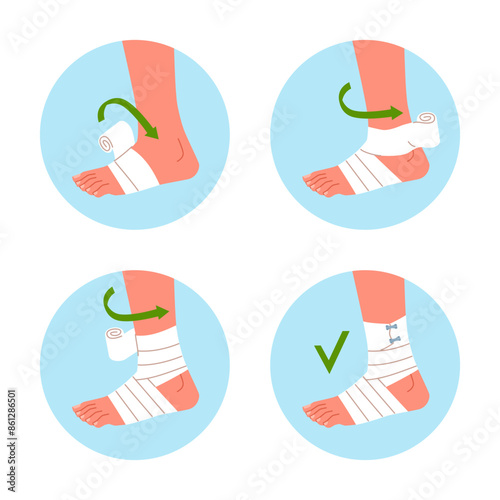 Bandaging scheme. Applying medical bandage or plaster on injured ankle, step by step instructions, trauma fixation, nowaday vector cartoon flat isolated traumatology infographics poster