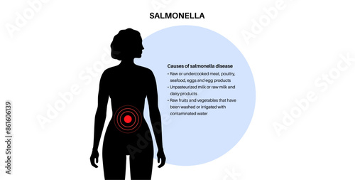 .Salmonella Typhimurium Cells photo
