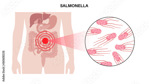.Salmonella Typhimurium Cells