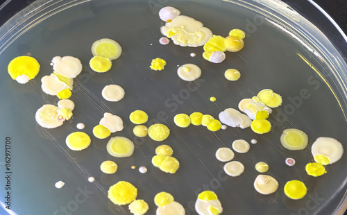 A Petri dish with colonies of bacteria of different colors photo