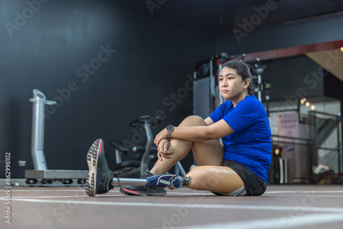 Athlete with prosthetic leg doing warm up exercise on Gym. Woman wearing prosthetic equipment for jogging. © kanpisut