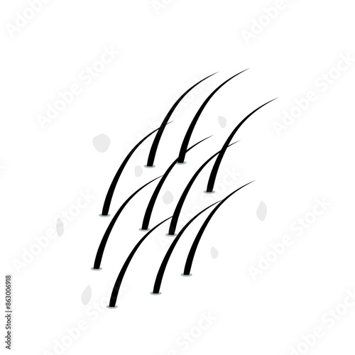 hair dandruff