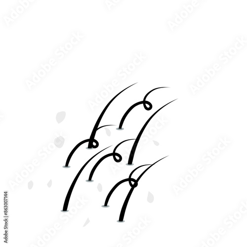 hair dandruff