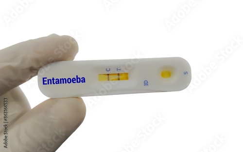 Entamoeba histolytica, rapid test cassette in doctor hand with white background. photo