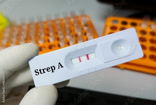 Bild auf Leinwand Rapid test cassette test showing positive for streptococcus group A (Strep A)