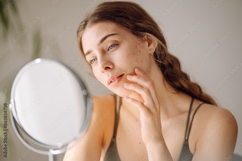 Young woman with problem skin looking into mirror. Concept of acne therapy, scars, inflammation on face, problem skin. Beauty care. Young woman with problem skin looking into mirror. Concept of acne therapy, scars, inflammation on face, problem skin. Beauty care.