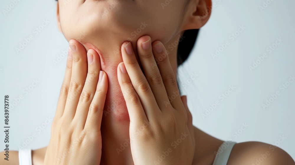 Fototapeta premium Red itching skin rash acene dot due to allergy