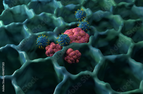 CAR T cell therapy in lung cancer (LC) - isometric view 3d illustration photo