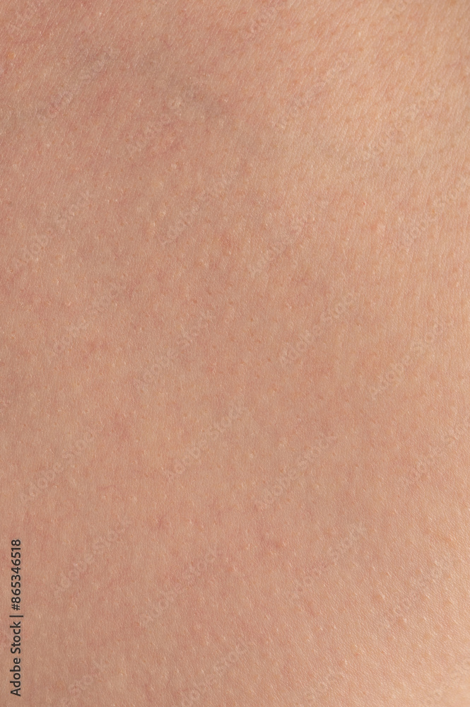 Rough human skin with dots Rough human skin with dots