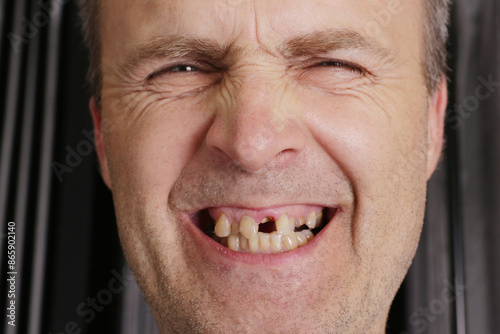 Portrait of a bad man with bad teeth.