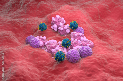 CAR T cell therapy in Ovarian cancer - isometric view 3d illustration