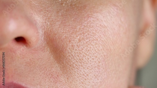 skin texture on large pores. oily troubled facial skin close-up. dermatology cosmetology concept