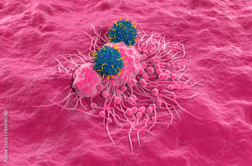 CAR T cell therapy in Thyroid cancer - isometric view 3d illustration