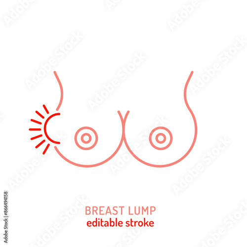Breast lump outline icon, pictogram. Abnormal thickening, swelling sign