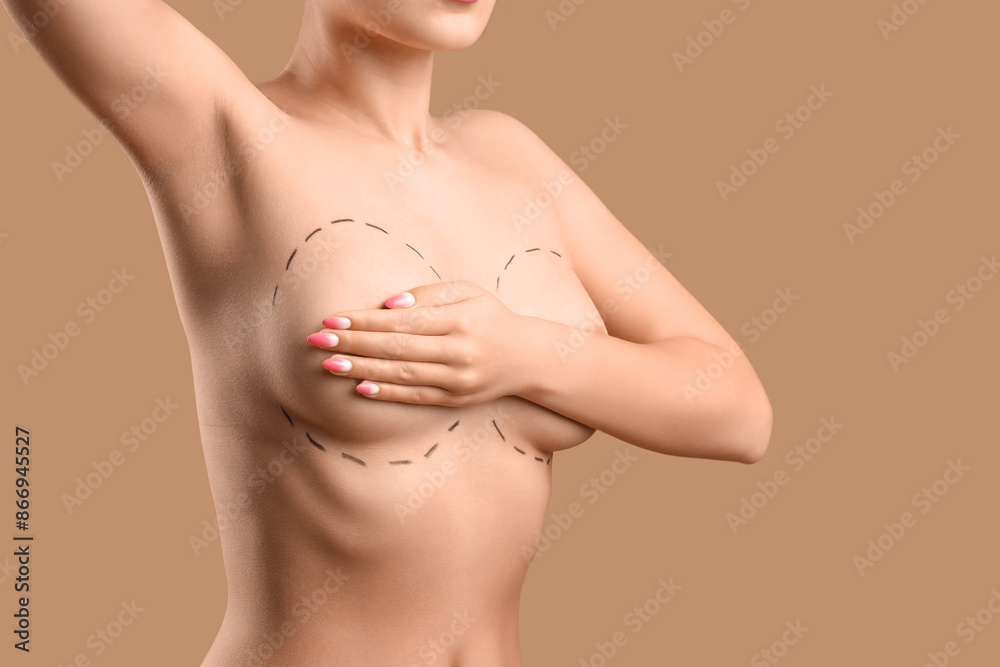 Naked young woman with marks on her breasts against brown background, closeup. Plastic surgery concept Naked young woman with marks on her breasts against brown background, closeup. Plastic surgery concept