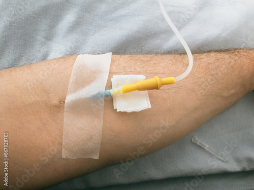 The patient's arm with an IV. The patient's hand, a needle with saline solution in the patient's hand during treatment in the hospital. Soft focus. The patient's arm with an intravenous drip.