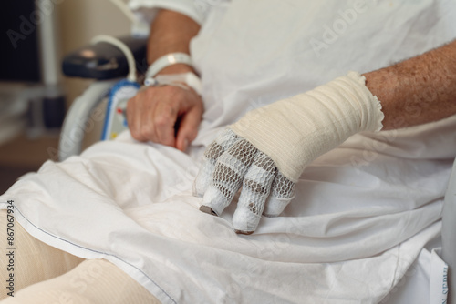 Burns Patient Recovery: Bandaged Hands in Hospital Care