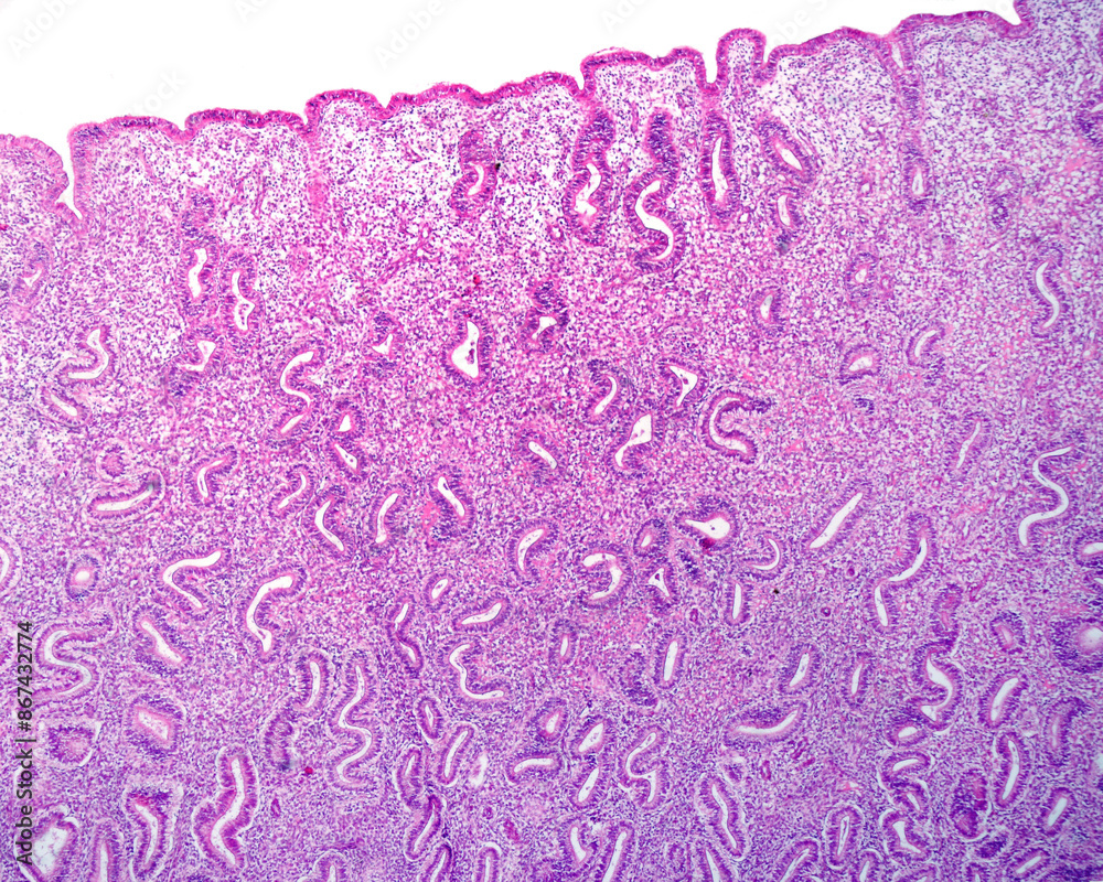 Endometrium. Basal layer. Late proliferative phase Endometrium. Basal layer. Late proliferative phase