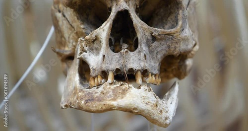 Human skull. Bones of human skull for studying photo