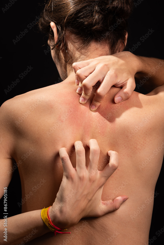 Young man, shirtless, scratching his back with his hands. Skin disease. Irritation, allergy. Young man, shirtless, scratching his back with his hands. Skin disease. Irritation, allergy.
