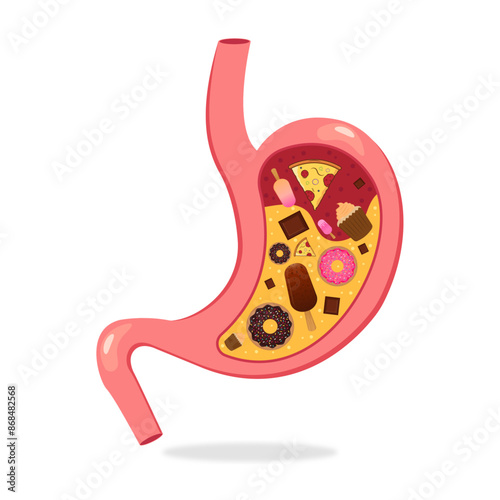 Stomach full of unhealthy food flat cartoon illustration. Overeating problem and stomach disease concept.