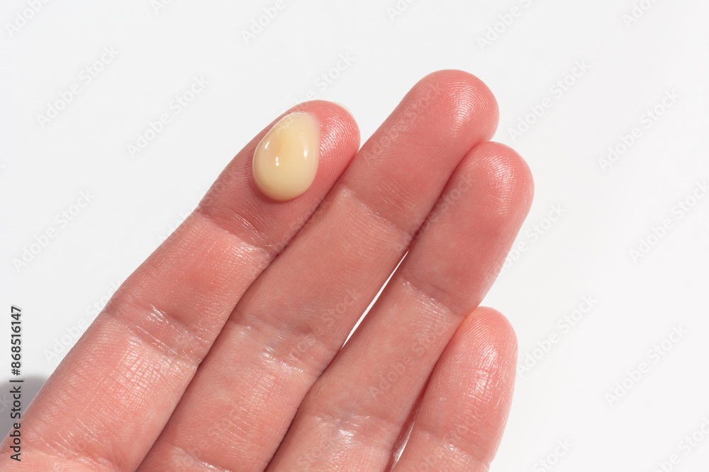 Closeup of a retinal serum.