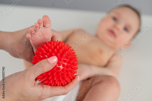 A doctor massages a baby's foot using a spiked ball.