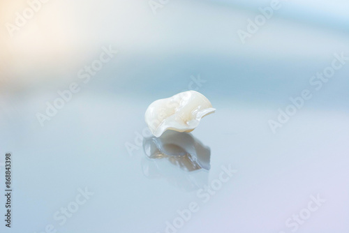 High-quality emax ceramic inlay lies on glass with color reflection
