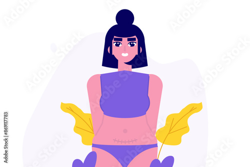 Women with cesarean scar. Stitches after caesarean section, C-section concept. Vector flat illustration isolated white background.