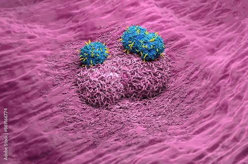 CAR T cell therapy in Liver cancer - isometric view 3d illustration photo