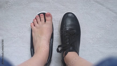 Wallpaper Mural Foot deforming shoes. Incorrect anatomical shoes with flat soles. Small insole size, which causes foot pain. Cause of valgus, calluses, ingrown toenails Torontodigital.ca