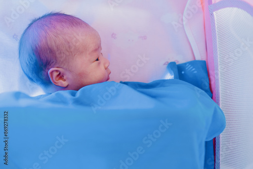 Neonatal jaundice under blue light