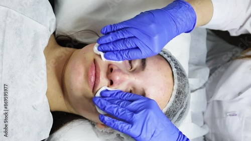 SPA treatments, facial skin rejuvenation. A cosmetologist wipes gel from a woman's face with cotton pads. Close-up.