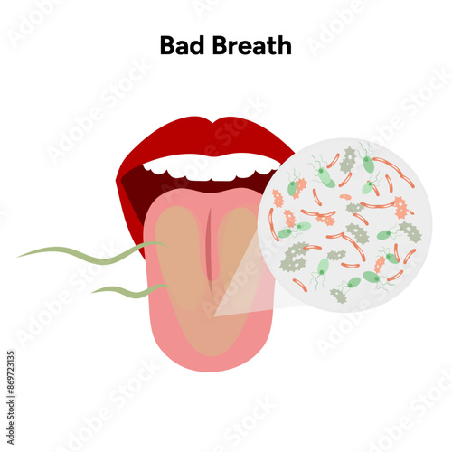Bad breath with bacteria in the mouth, halitosis