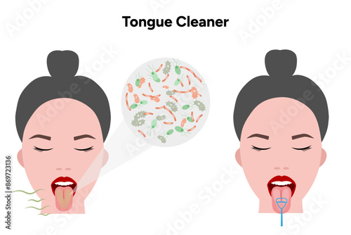 Bad breath with bacteria in the mouth with female face