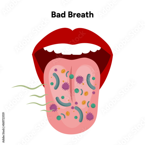 Bad breath with bacterials in the mouth