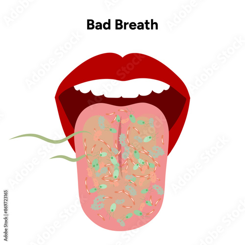 Bad breath with bacterias in the mouth
