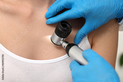 Dermatologist with dermatoscope examining patient, closeup view photo