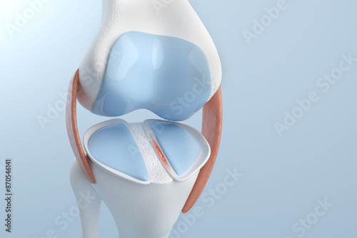 Canvas-taulu Knee pain from Meniscus Tear for medical and treatment