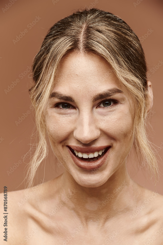 A close-up portrait of a young woman with vitiligo smiling with bare shoulders against a beige background.