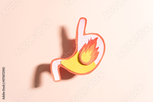 Cuadro en lienzo Human stomach burn with acid reflux and fire made from paper