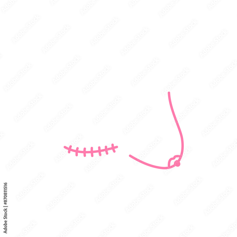 Mastectomy doodle logo sign icon Female human form illustrated with scars Hand drawn ink sketch Human rights concept Anatomy design style Print for medical educational card banner poster cover book ad Mastectomy doodle logo sign icon Female human form illustrated with scars Hand drawn ink sketch Human rights concept Anatomy design style Print for medical educational card banner poster cover book ad