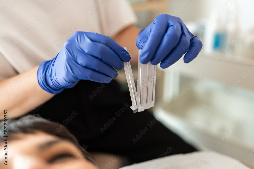 Doctor preparing for needling therapy. Doctor preparing for needling therapy.