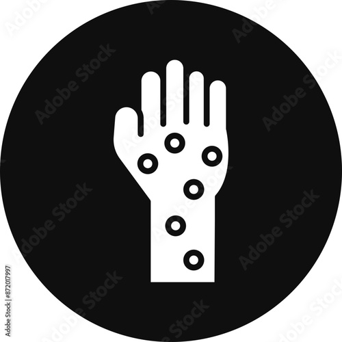 Hand Rash Vector Glyph Black Circle Icon